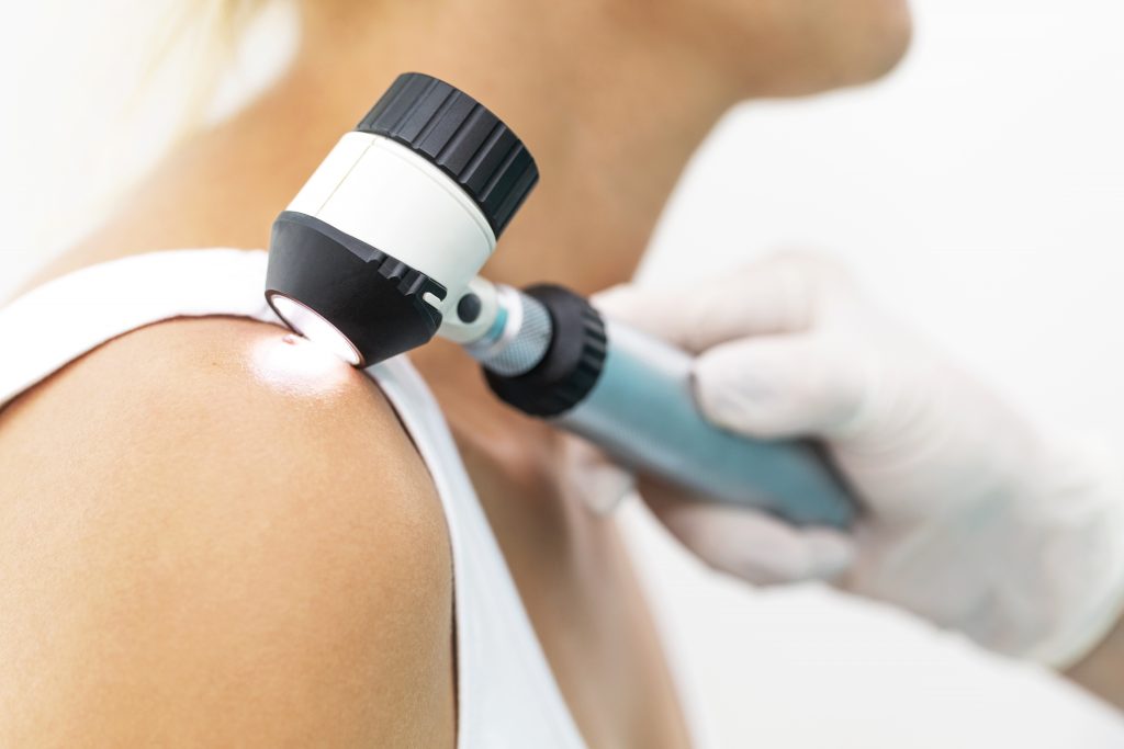 Close-up of a dermatoscope being used to examine skin during a Mobile Screening onsite skin cancer check.